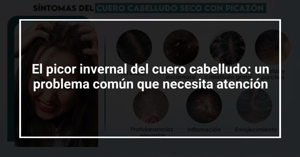 El picor invernal del cuero cabelludo: un problema común que necesita atención